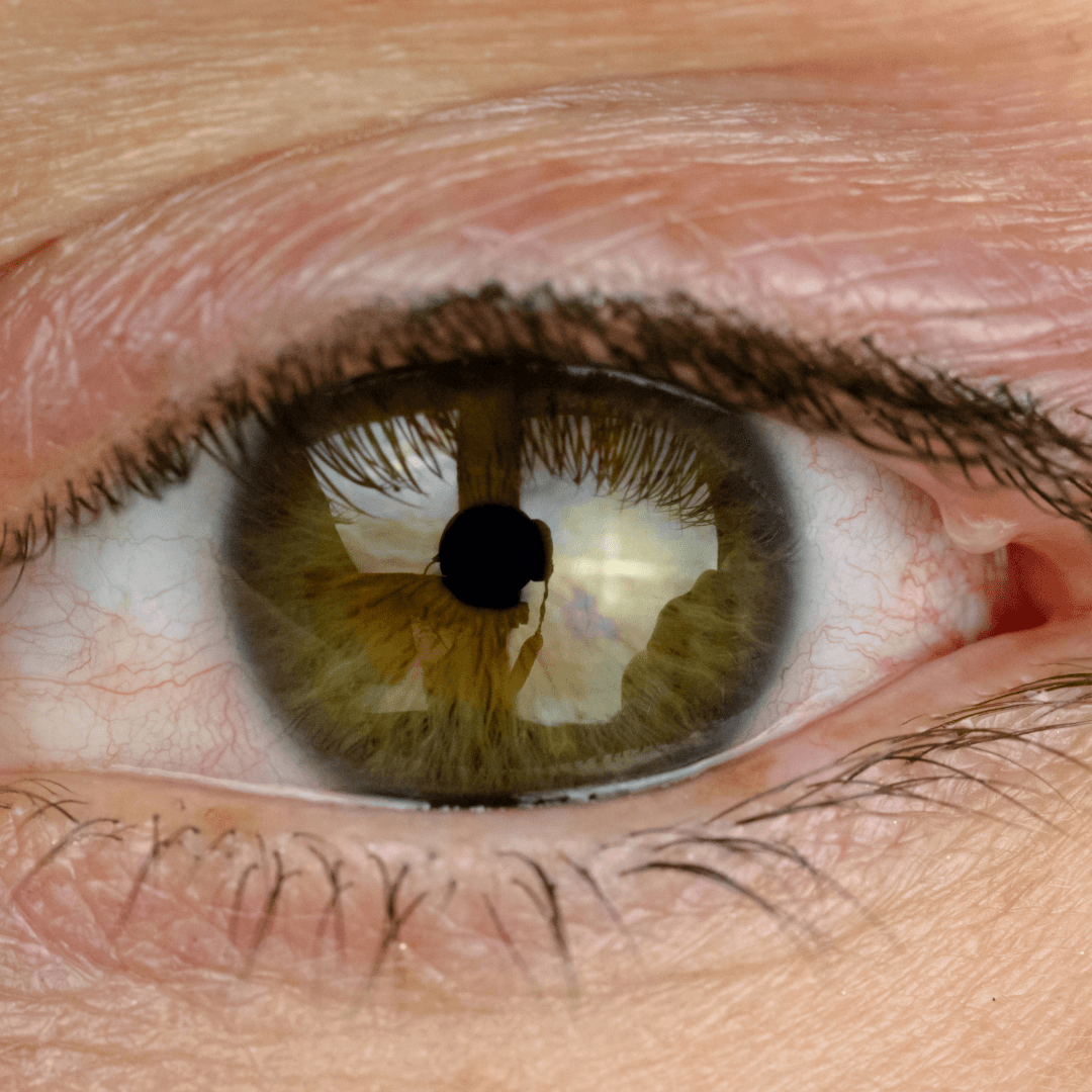 Effective Treatment for Styes