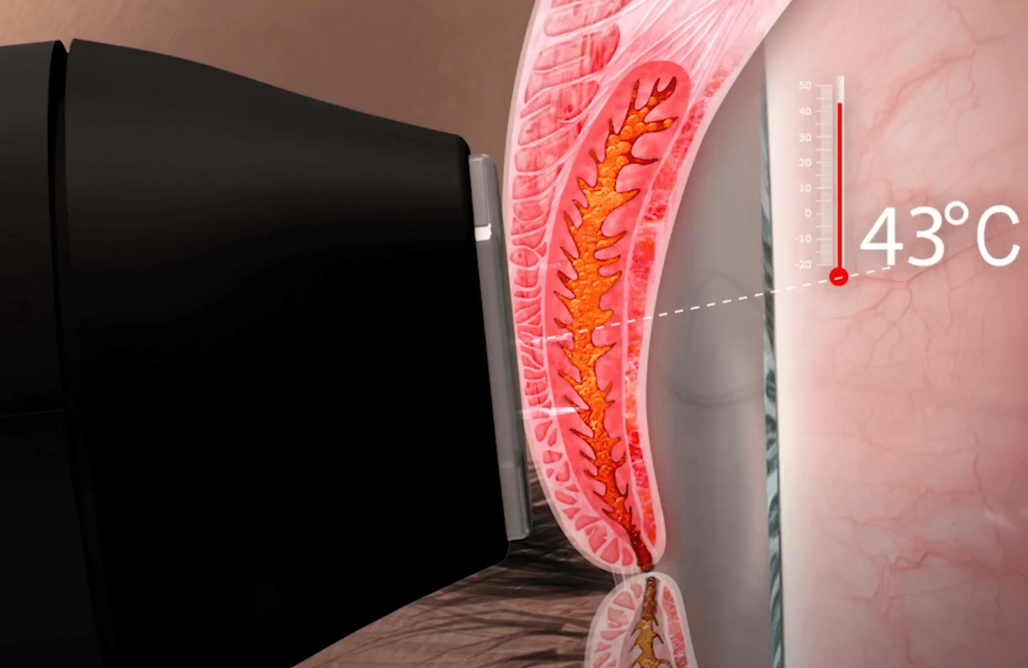 Discover the Appearance Of Younger Looking Skin with Forma-I