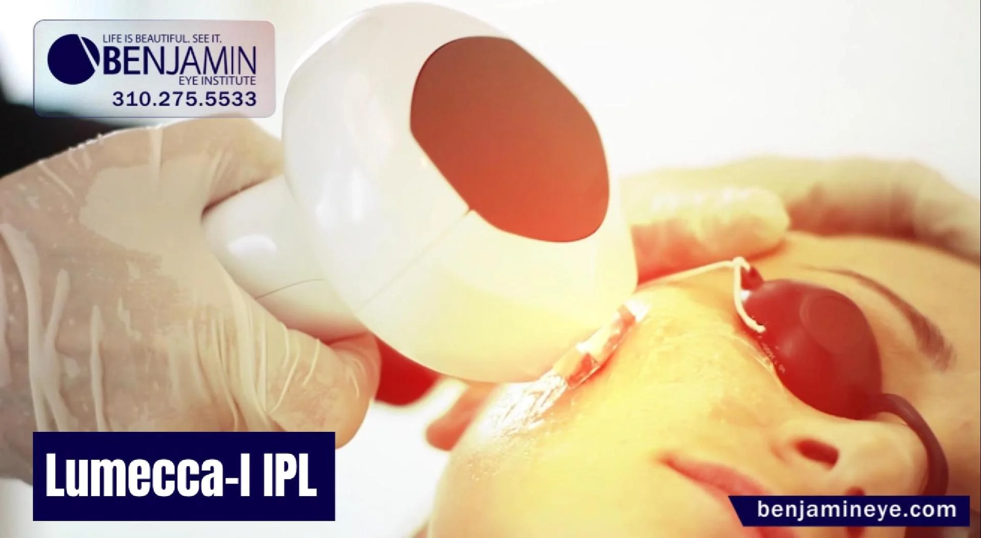 Lumecca-I IPL: Your Path to Clearer, Healthier Skin