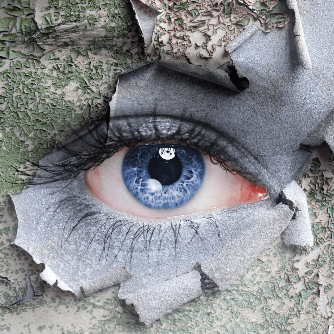 What You Need to Know About Dry Eye